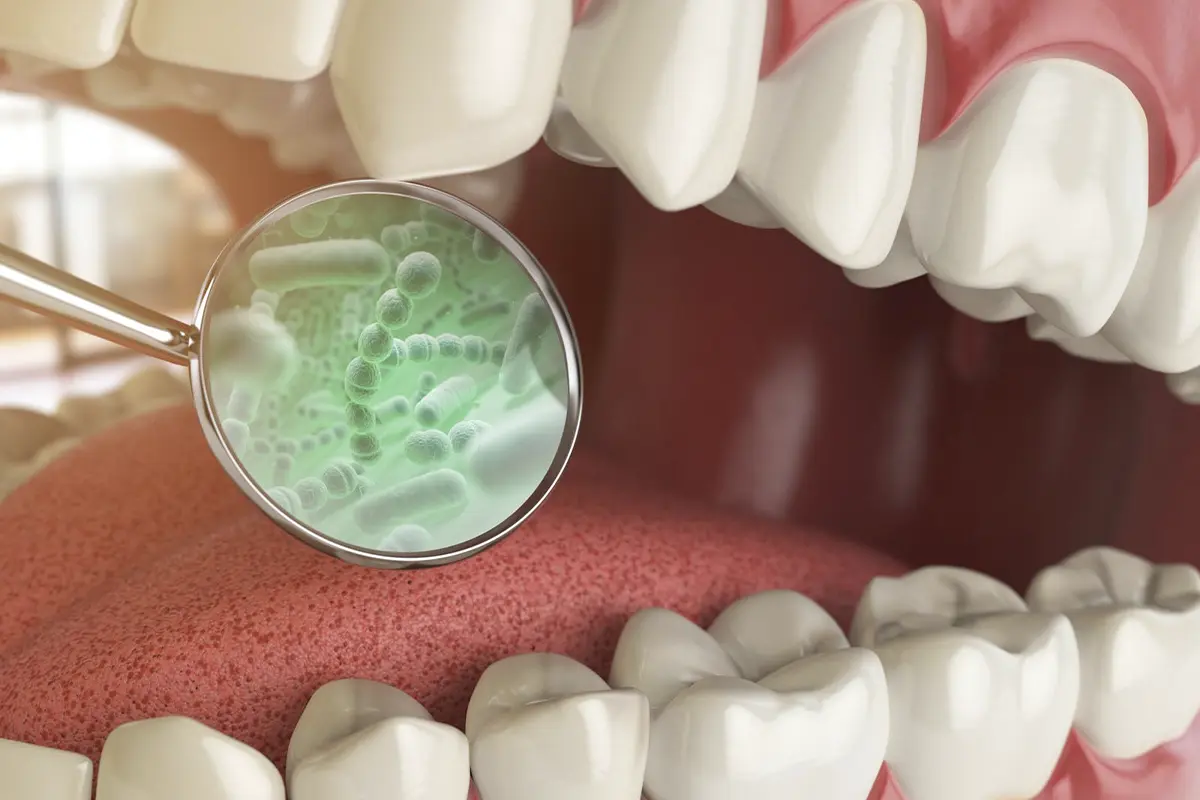 Bad Breath Treatment