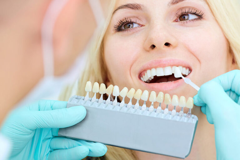 Dentist matching the shade of a patient's teeth using a dental shade guide, with the patient smiling and looking pleased.