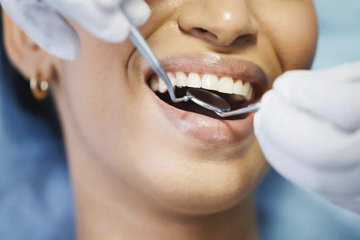 Dental Checkup