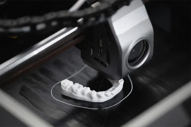 3D Printer technology at The Dentist of Siouxland in Sioux City, IA and Elk Point, SD