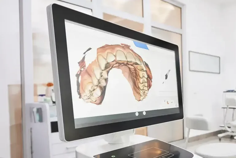 Digital scanner at The Dentist of Siouxland in Sioux City, IA and Elk Point, SD